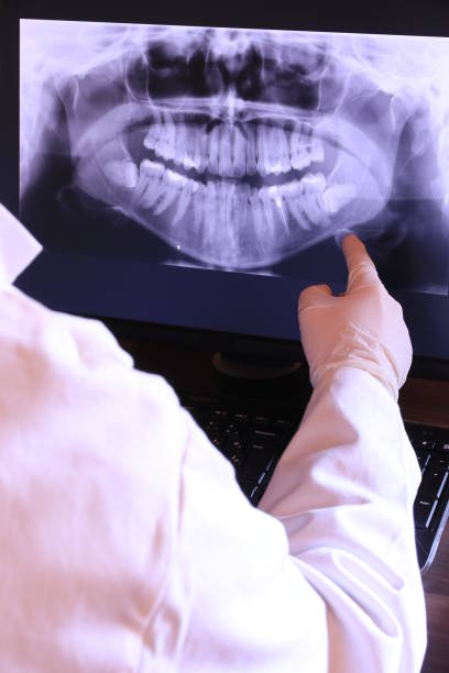Best Emergency Dental Care for Broken or Chipped Teeth in Morrison, IL