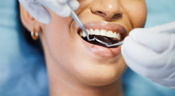 Best After-Hours Dental Trauma Care in Morrison, IL