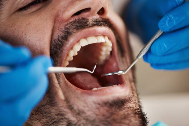 Best Cosmetic Emergency Dentistry in Morrison, IL