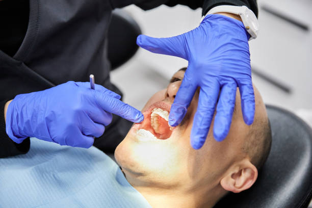 Best Emergency Dental Care for Broken or Chipped Teeth in Morrison, IL