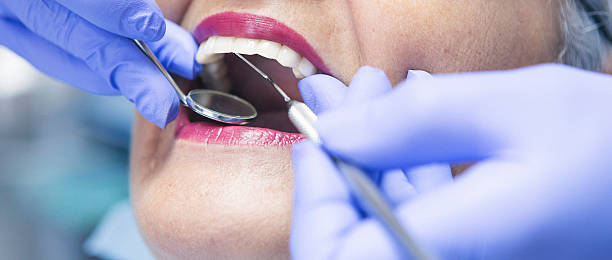 Best Emergency Tooth Extraction in Morrison, IL
